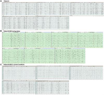 AARS and CACNA1A mutations: diagnostic insights into a case report of uncommon epileptic encephalopathy phenotypes in two siblings